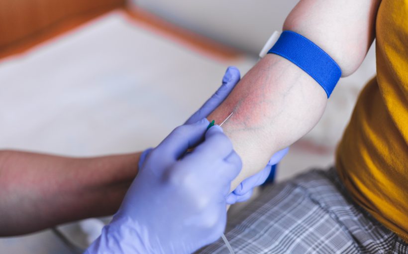 Pielęgniarka pobiera pacjentowi krew z wyraźnie widocznej żyły. /Źródło: 123rf.com