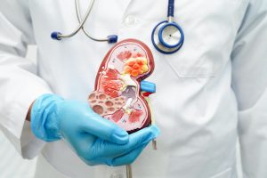 Lekarz nefrolog przeprowadza konsultację medyczną. /Źródło: 123rf.com