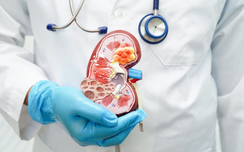 Lekarz nefrolog przeprowadza konsultację medyczną. /Źródło: 123rf.com