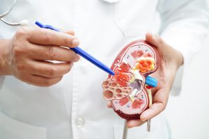 Lekarz wskazuje na modelu nerki tkankę. /Źródło: 123rf.com