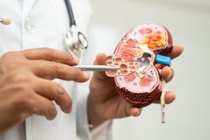 Lekarz przeprowadza konsultację, wskazując na modelu nerki chore tkanki. /Źródło: 123rf.com