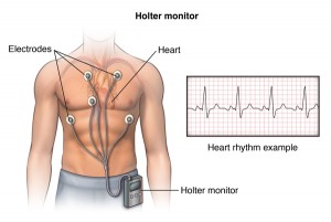 holter ekg kraków, holter ekspresowy , holter 24 h, holter 24 godz, poradnia kardiologiczna, pracownia holterowska, holter ekspresowy opis, szybki opis badania holtera ekg kraków