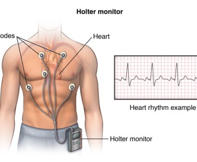 holter ekg kraków, holter ekspresowy , holter 24 h, holter 24 godz, poradnia kardiologiczna, pracownia holterowska, holter ekspresowy opis, szybki opis badania holtera ekg kraków