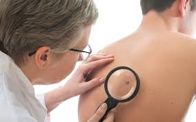 dermatolog łódź, poradnia dermatologiczna w łodzi, specjalista dermatologii, przychodnia dermatologiczna