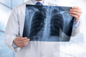 Lekarz ogląda zdjęcie rentgenowskie pacjenta. /Źródło: 123rf.com
