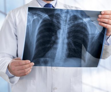 Lekarz ogląda zdjęcie rentgenowskie pacjenta. /Źródło: 123rf.com
