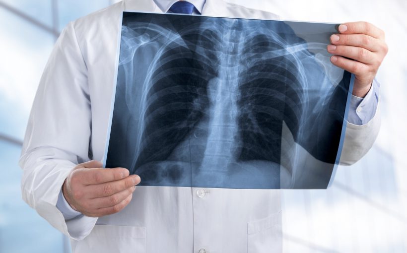 Lekarz ogląda zdjęcie rentgenowskie pacjenta. /Źródło: 123rf.com