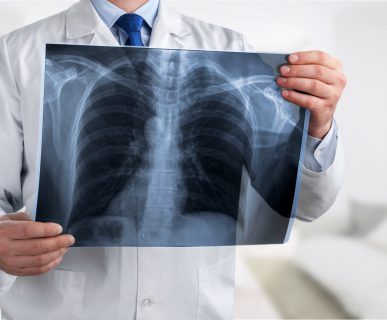 Lekarz specjalista radiolog trzyma w dłoni rentgen klatki piersiowej pacjenta. /Źródło: 123rf.com