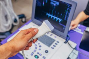 Lekarz przygotowuje sprzęt diagnostyczny do wykonania USG doppler. /Źródło: 123rf.com