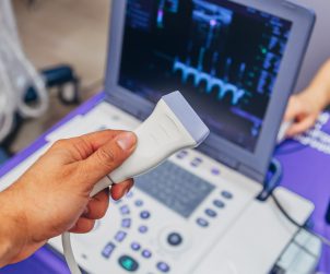 Lekarz przygotowuje sprzęt diagnostyczny do wykonania USG doppler. /Źródło: 123rf.com