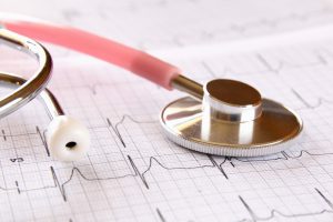 Stetoskop leży na wydrukowanym opisie EKG. /Źródło: 123rf.com