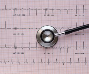 Stetoskop leży na wydrukowanym opisie EKG pacjenta. /Źródło: 123rf.com