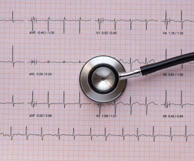 Stetoskop leży na wydrukowanym opisie EKG pacjenta. /Źródło: 123rf.com