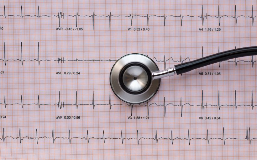 Stetoskop leży na wydrukowanym opisie EKG pacjenta. /Źródło: 123rf.com