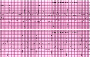 EKG z opisem Nowy Sącz