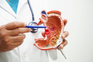 Lekarz wskazuje część żołądka na modelu anatomicznym. /Źródło: 123rf.com