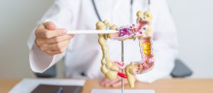 Lekarz wskazuje pacjentowi na modelu układu pokarmowym poszczególne narządy i opowiada o objawach i planie leczenia. /Źródło: 123rf.com