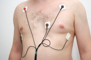 Mężczyzna ma założony na ciało holter EKG, aby zdiagnozować ewentualne choroby kardiologiczne. /Źródło: 123rf.com