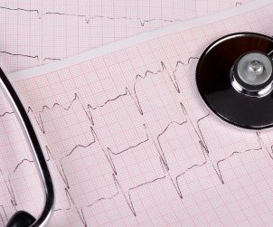 Taśma z zapisem z EKG pacjenta, na której położony jest stetoskop. /Źródło: 123rf.com