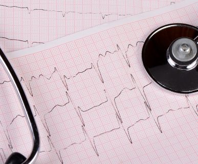 Taśma z zapisem z EKG pacjenta, na której położony jest stetoskop. /Źródło: 123rf.com