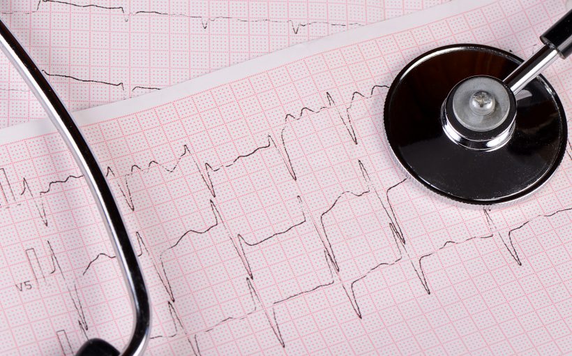 Taśma z zapisem z EKG pacjenta, na której położony jest stetoskop. /Źródło: 123rf.com