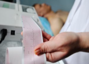 Pielęgniarka drukuje zapis EKG pacjenta. /Źródło: 123rf.com
