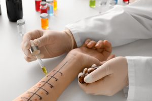 Lekarz alergolog przeprowadza testy skórne na ręce pacjenta. /Źródło: 123rf.com