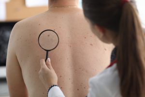 Lekarz dermatolog sprawdza zmiany na plecach pacjenta. /Źródło: 123rf.com