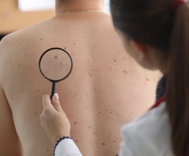 Lekarz dermatolog sprawdza zmiany na plecach pacjenta. /Źródło: 123rf.com