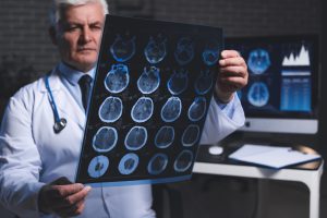 Lekarz specjalista neurologii przegląda wynik tomografii komputerowej głowy swojego pacjenta. /Źródło: 123rf.com