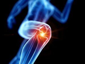 Grafika przedstawia układ kostny człowieka z zaznaczonym urazem kolana. /Źródło: 123rf.com
