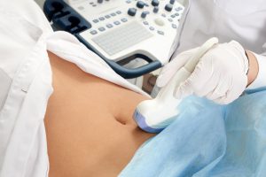 Lekarka wykonuje badanie USG jamy brzusznej pacjentce. /Źródło: 123rf.com