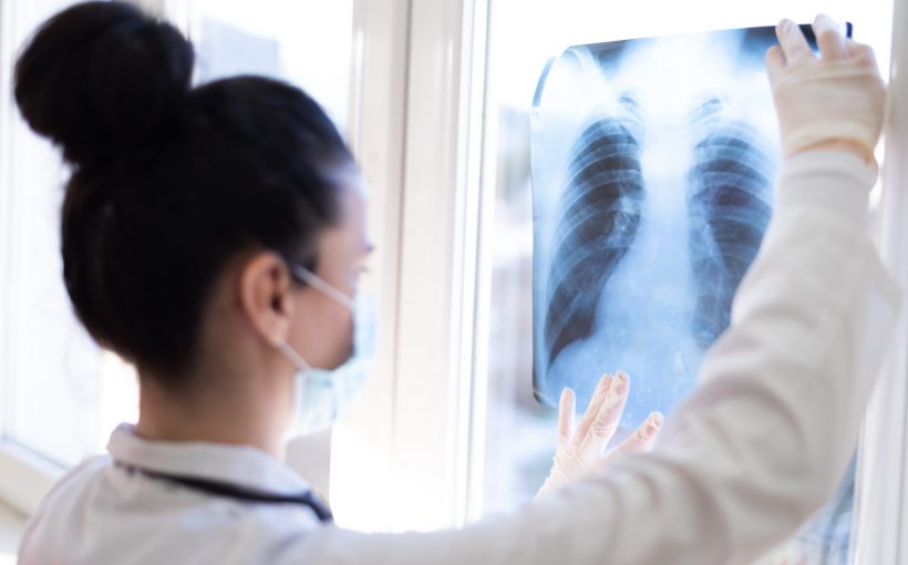 Lekarka analizuje obraz z wykonanego wcześniej RTG płuc pacjenta. /Źródło: 123rf.com
