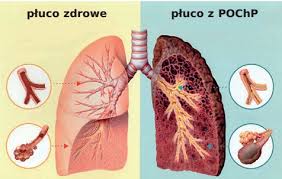 Spirometria Nowy Sącz