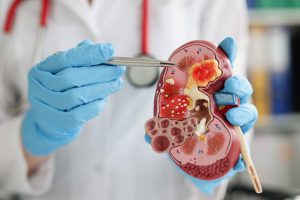 Lekarz wskazuje na nerce strukturę tłumacząc pacjentowi dalsze leczenie. /Źródło: 123rf.com