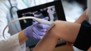 Lekarz wykonuje USG stawu kolanowego pacjentce. /Źródło: 123rf.com