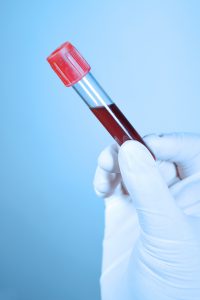 Pielęgniarz trzyma w dłoni odzianej w sterylną rękawiczkę, probówkę wypełnioną krwią pacjenta, pobraną w celu diagnostyki laboratoryjnej. /Źródło: 123rf.com