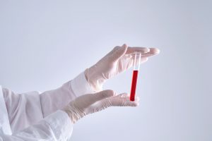 Pielęgniarka ubrana w sterylny, medyczny strój trzyma w dłoni fiolkę wypełnioną wcześniej pobraną krwią pacjenta. /Źródło: 123rf.com