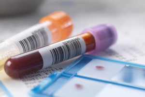 Badania krwi jędrzejów laboratorium godziny otwarcia cennik