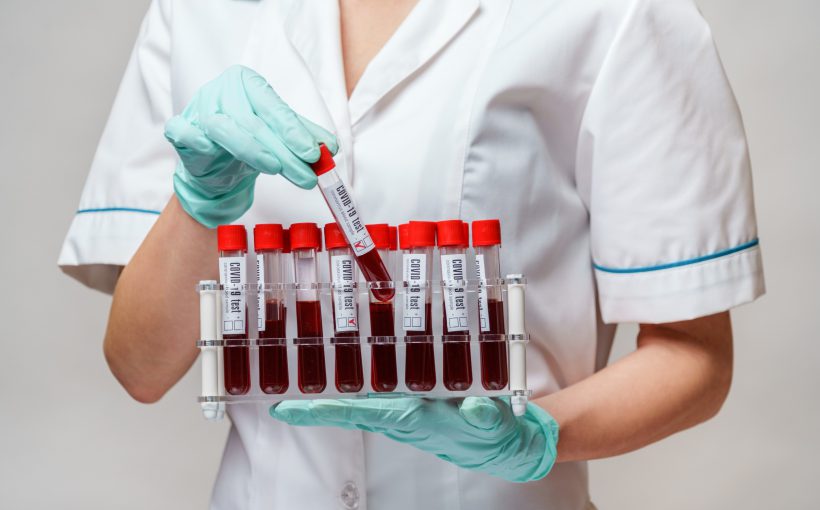 Pielęgniarka w medycznym stroju trzyma w dłoniach probówki wypełnione wcześniej pobraną krwią pacjentów. /Źródło: 123rf.com