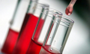 Badanie krwi Pińczów laboratorium cennik godziny otwarcia