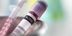 Badanie krwi Pińczów cennik pobranie