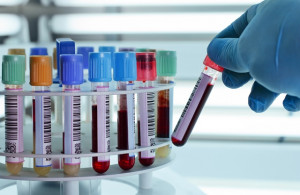 Badanie krwi częstochowa laboratorium tanio wyniki godziny otwarcia