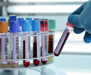 Badanie krwi częstochowa laboratorium tanio wyniki godziny otwarcia