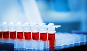 Badanie krwi Częstochowa laboratorium godziny otwarcia cennik wyniki krwi