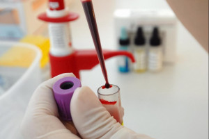 Częstochowa badania krwi laboratorium ceny badań
