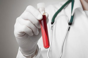 Badanie krwi Katowice laboratorium godziny otearcia ceny badań