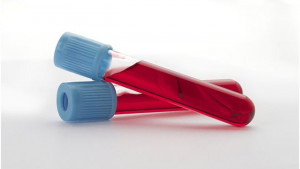 Badania krwi Katowice laboratorium godziny otwarcia cennik wyniki krwi