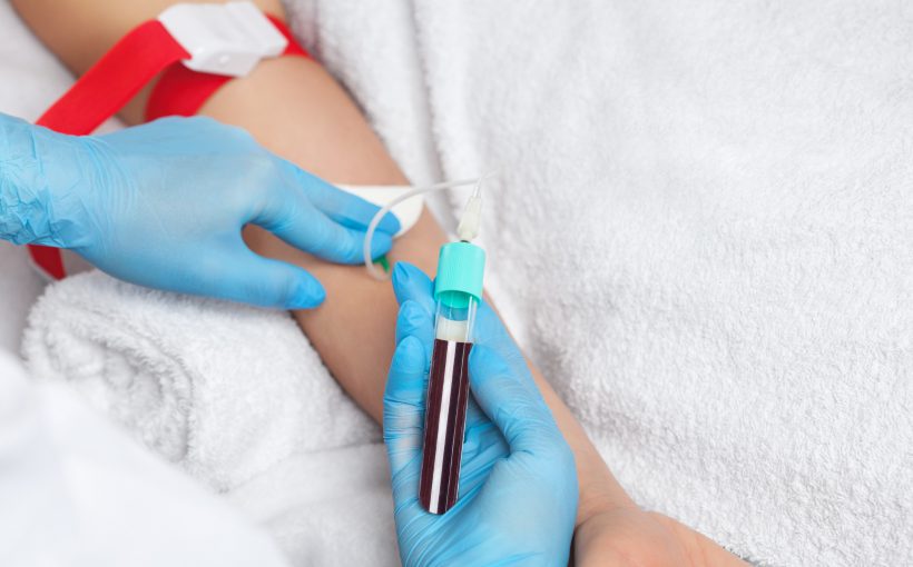 Pielęgniarka pobiera pacjentowi krew z żyły w celu przekazania jej do laboratorium medycznego. /Źródło: 123rf.com