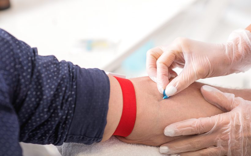 Pielęgniarka pobiera pacjentowi krew z żyły u ręki. /Źródło: 123rf.com
